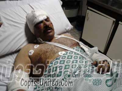 Militias of the MB seriously injured Coptic activist Amir Ayad 